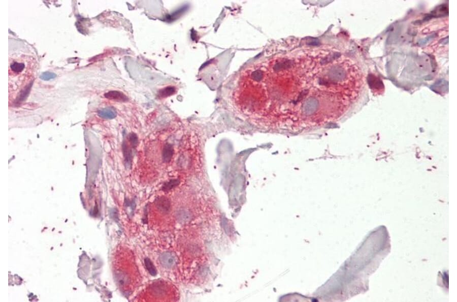 Immunohistochemistry - Anti-CHRNA5 Antibody (A84974) - Antibodies.com
