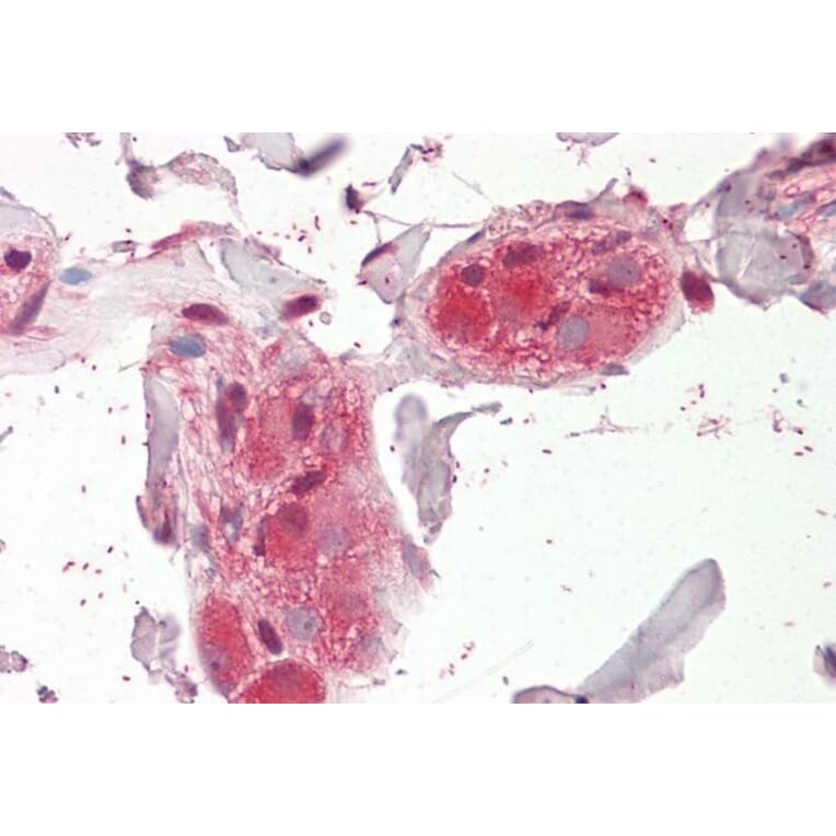 Immunohistochemistry - Anti-CHRNA5 Antibody (A84974) - Antibodies.com