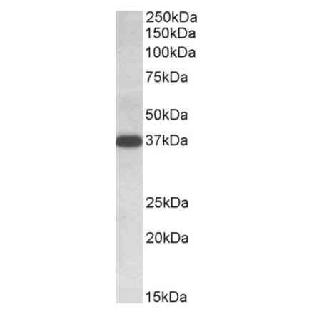 Western Blot - Anti-IDH3A Antibody (A84975) - Antibodies.com