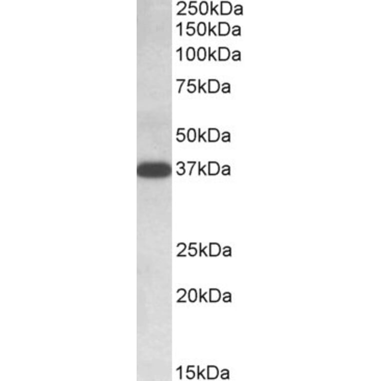 Western Blot - Anti-IDH3A Antibody (A84975) - Antibodies.com