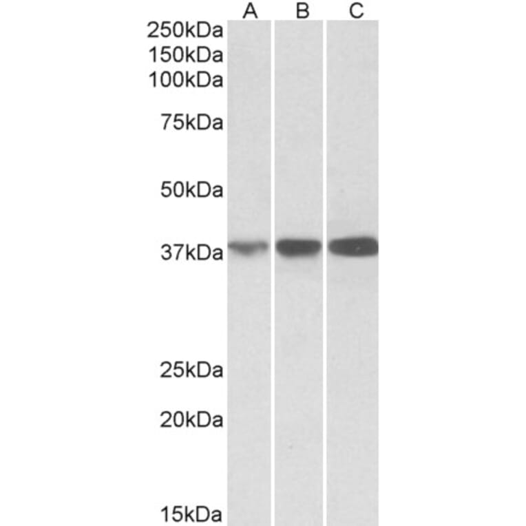 Western Blot - Anti-IDH3A Antibody (A84975) - Antibodies.com