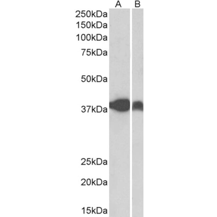 Western Blot - Anti-IDH3A Antibody (A84975) - Antibodies.com