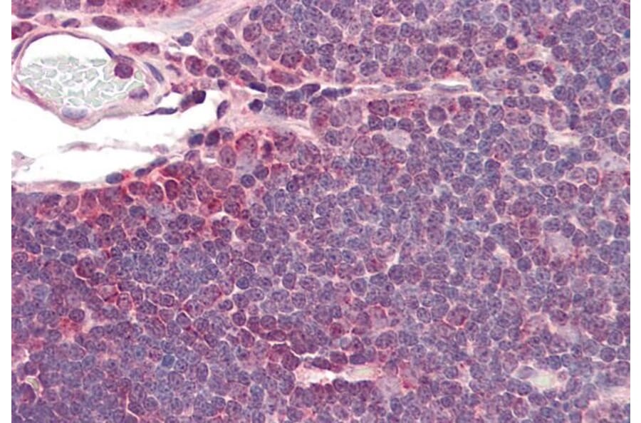 Immunohistochemistry - Anti-IDH3A Antibody (A84975) - Antibodies.com
