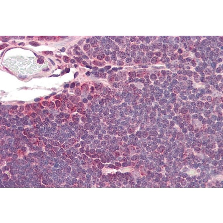 Immunohistochemistry - Anti-IDH3A Antibody (A84975) - Antibodies.com