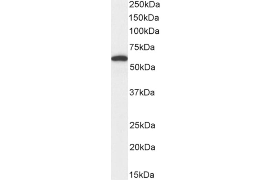 Western Blot - Anti-DGAT1 Antibody (A84976) - Antibodies.com