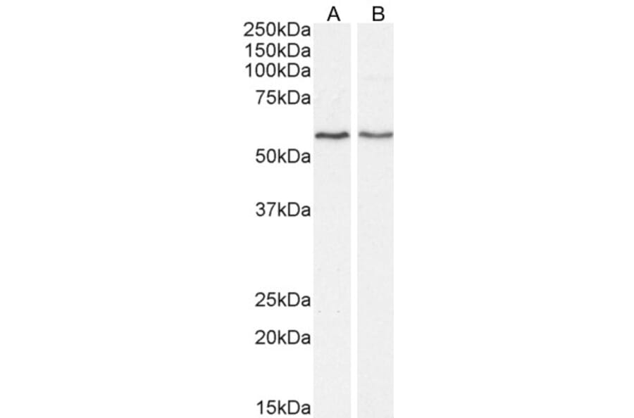 Western Blot - Anti-DGAT1 Antibody (A84976) - Antibodies.com