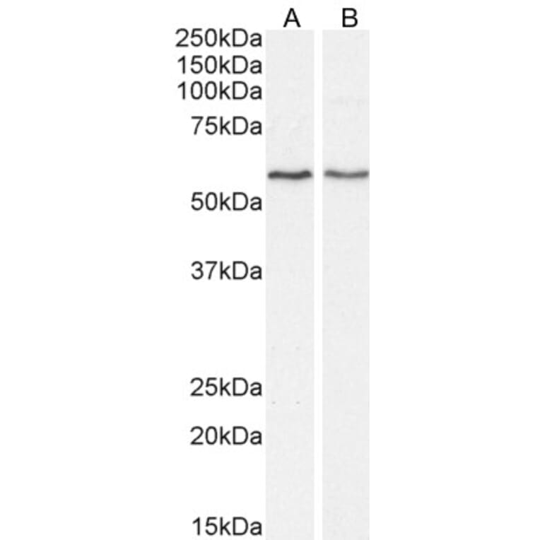 Western Blot - Anti-DGAT1 Antibody (A84976) - Antibodies.com
