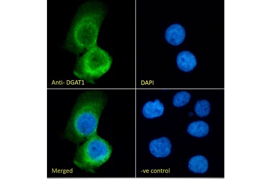 Immunofluorescence - Anti-DGAT1 Antibody (A84976) - Antibodies.com