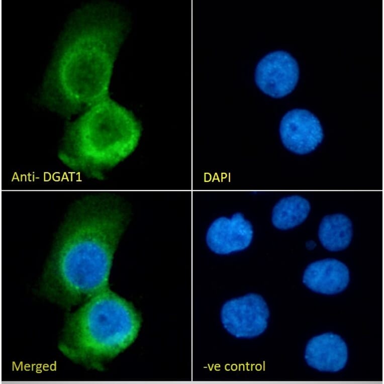 Immunofluorescence - Anti-DGAT1 Antibody (A84976) - Antibodies.com