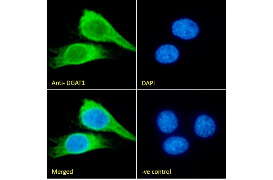 Immunofluorescence - Anti-DGAT1 Antibody (A84976) - Antibodies.com