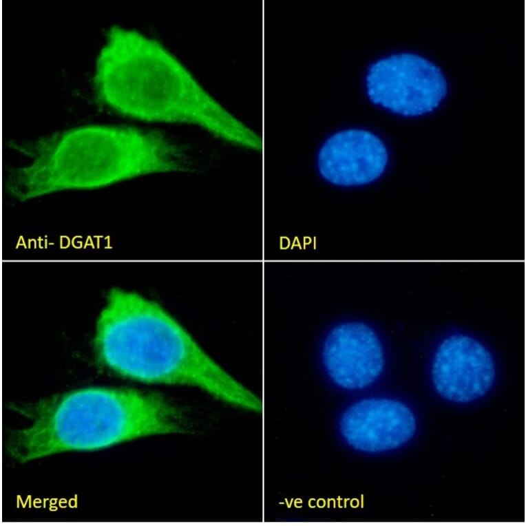 Immunofluorescence - Anti-DGAT1 Antibody (A84976) - Antibodies.com