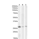 Western Blot - Anti-DNAJB9 Antibody (A84978) - Antibodies.com