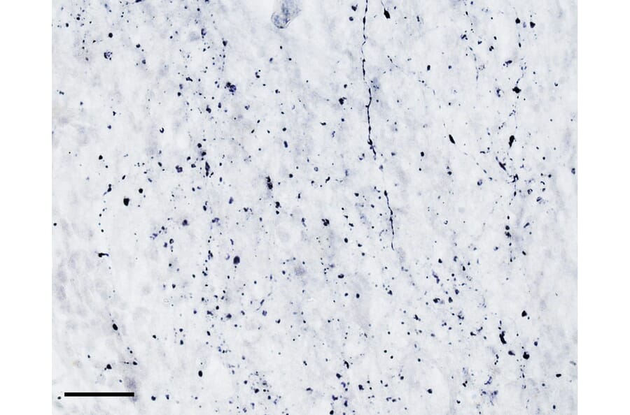 Immunohistochemistry - Anti-TPH2 Antibody (A84979) - Antibodies.com