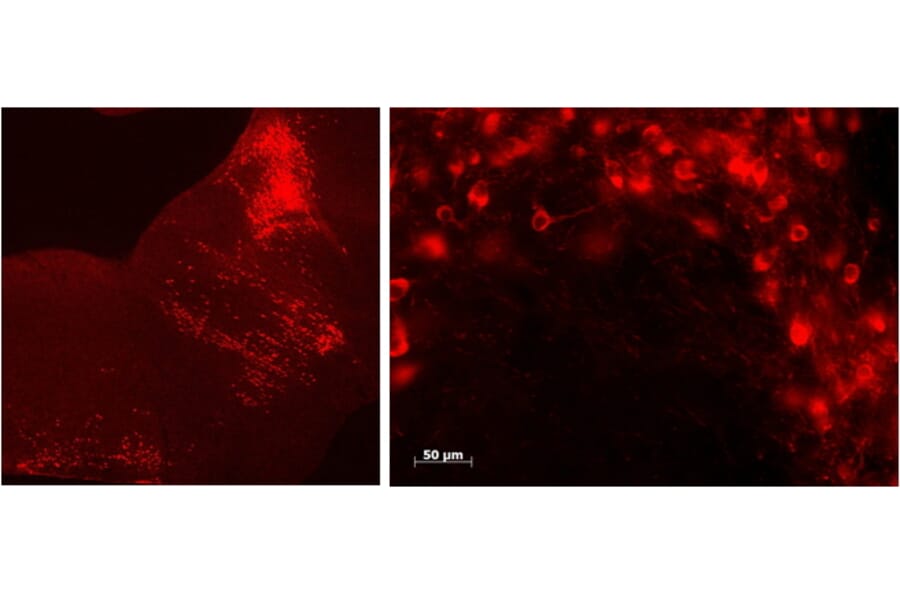 Immunofluorescence - Anti-TPH2 Antibody (A84980) - Antibodies.com