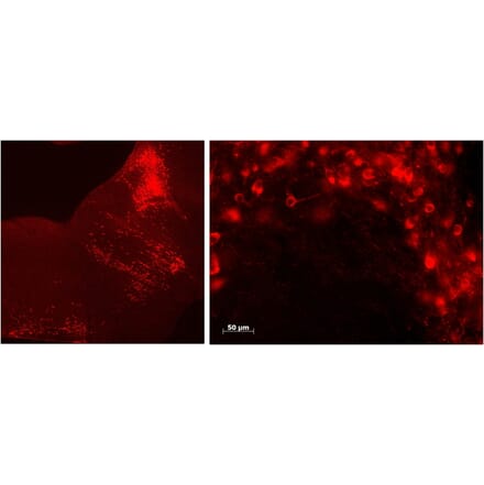 Immunofluorescence - Anti-TPH2 Antibody (A84980) - Antibodies.com