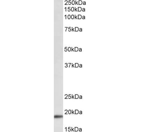 Western Blot - Anti-WFDC1 Antibody (A84981) - Antibodies.com