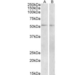Western Blot - Anti-VPAC1 Antibody (A84982) - Antibodies.com