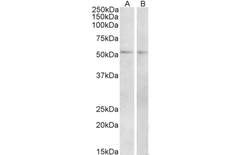 Western Blot - Anti-VPAC1 Antibody (A84982) - Antibodies.com