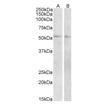 Western Blot - Anti-VPAC1 Antibody (A84982) - Antibodies.com