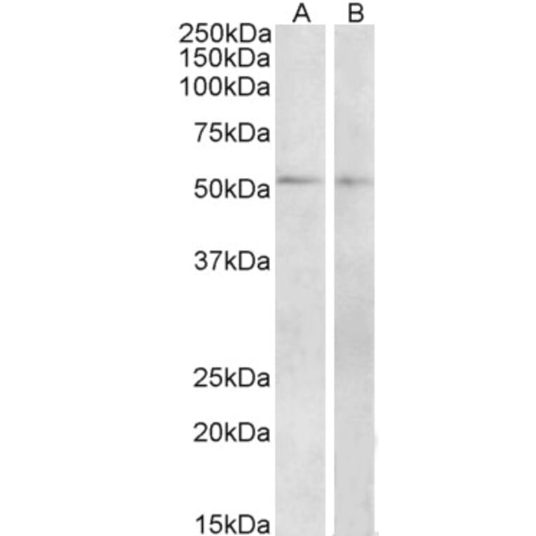 Western Blot - Anti-VPAC1 Antibody (A84982) - Antibodies.com