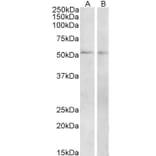 Western Blot - Anti-VPAC1 Antibody (A84982) - Antibodies.com