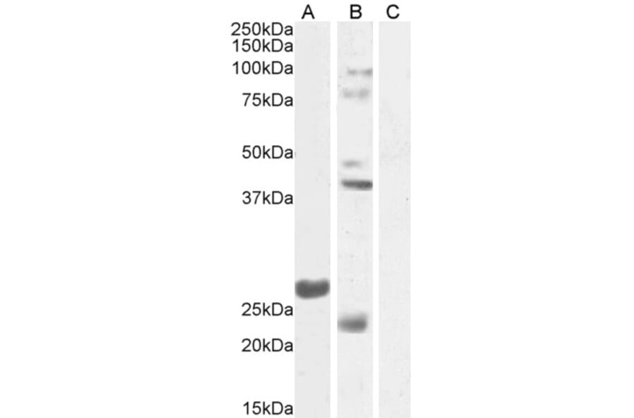 Western Blot - Anti-FGF23 Antibody (A84983) - Antibodies.com