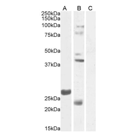 Western Blot - Anti-FGF23 Antibody (A84983) - Antibodies.com