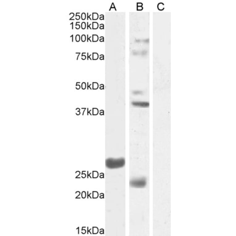 Western Blot - Anti-FGF23 Antibody (A84983) - Antibodies.com