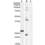 Western Blot - Anti-FGF23 Antibody (A84983) - Antibodies.com