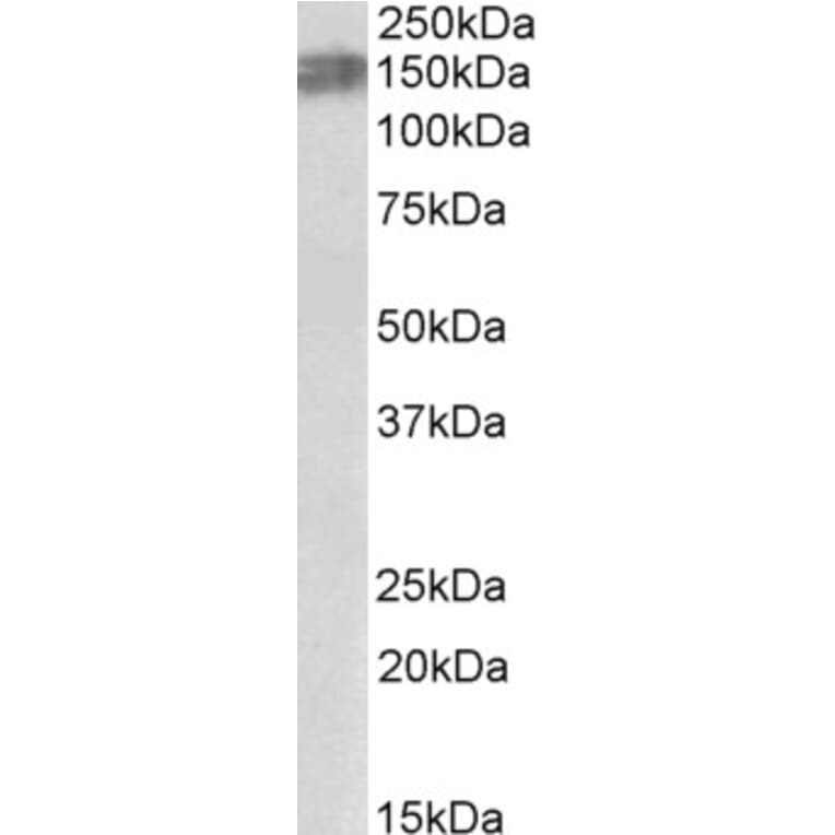 Western Blot - Anti-ALK Antibody (A84984) - Antibodies.com