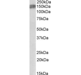 Western Blot - Anti-Alk Antibody (A84984) - Antibodies.com