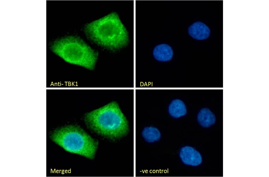 Immunofluorescence - Anti-NAK/TBK1 Antibody (A84985) - Antibodies.com