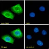 Immunofluorescence - Anti-NAK/TBK1 Antibody (A84985) - Antibodies.com