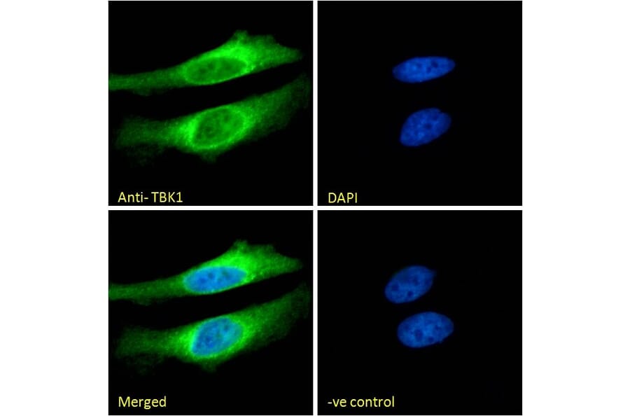 Immunofluorescence - Anti-NAK/TBK1 Antibody (A84985) - Antibodies.com