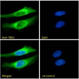 Immunofluorescence - Anti-NAK/TBK1 Antibody (A84985) - Antibodies.com