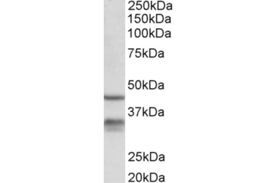 Western Blot - Anti-HSD11B1 Antibody (A84986) - Antibodies.com