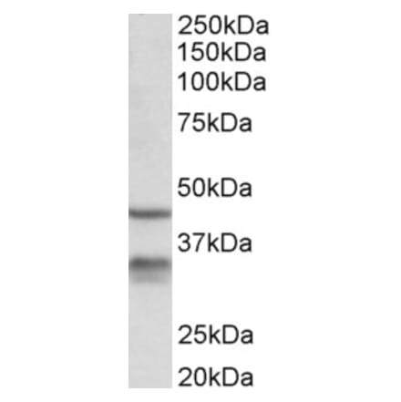 Western Blot - Anti-HSD11B1 Antibody (A84986) - Antibodies.com