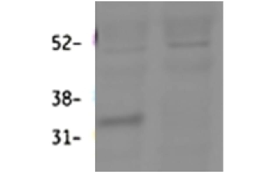 Western Blot - Anti-HSD11B1 Antibody (A84986) - Antibodies.com
