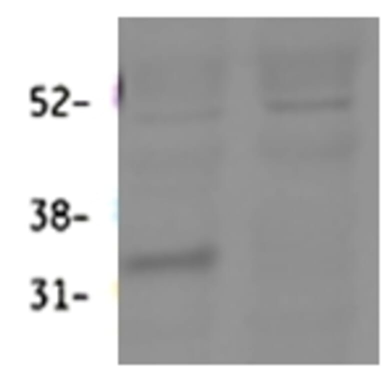 Western Blot - Anti-HSD11B1 Antibody (A84986) - Antibodies.com