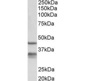 Western Blot - Anti-Hsd11b1 Antibody (A84986) - Antibodies.com