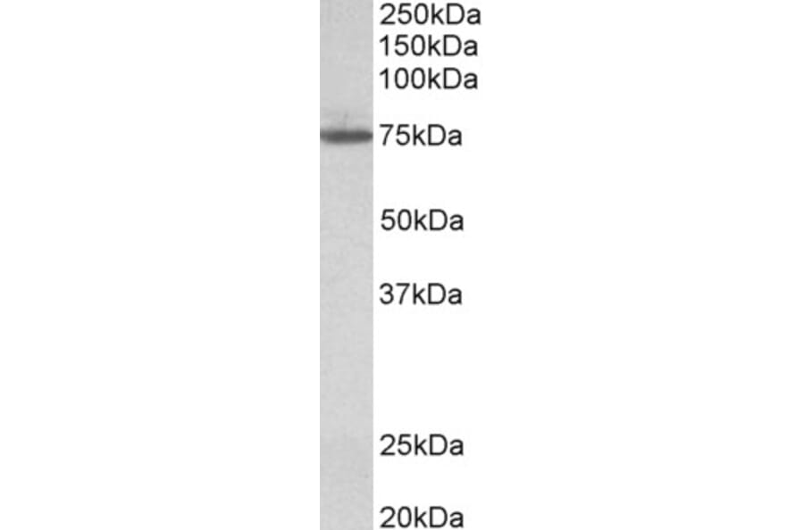 Western Blot - Anti-TGM4 Antibody (A84988) - Antibodies.com