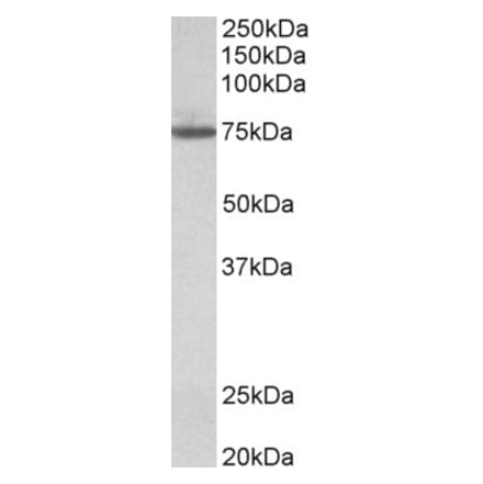 Western Blot - Anti-TGM4 Antibody (A84988) - Antibodies.com