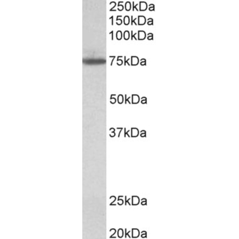 Western Blot - Anti-TGM4 Antibody (A84988) - Antibodies.com