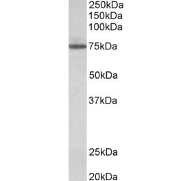 Western Blot - Anti-TGM4 Antibody (A84988) - Antibodies.com