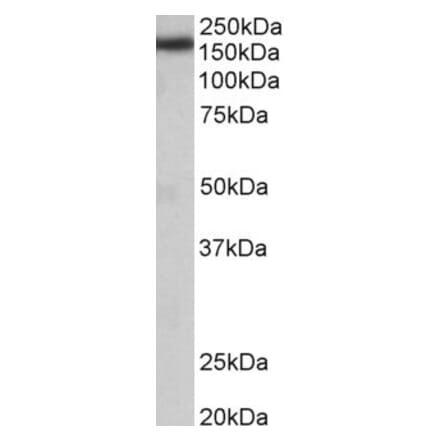 Western Blot - Anti-ZCCHC11 Antibody (A84989) - Antibodies.com