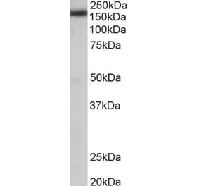 Western Blot - Anti-Zcchc11 Antibody (A84989) - Antibodies.com