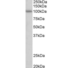 Western Blot - Anti-SIDT1 Antibody (A84990) - Antibodies.com