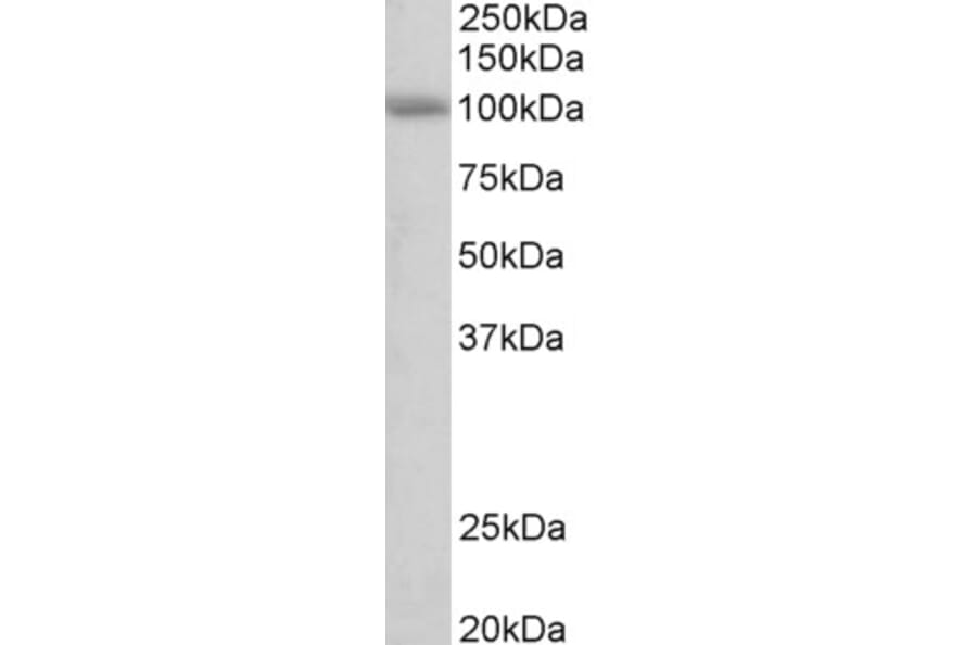 Western Blot - Anti-SIDT1 Antibody (A84990) - Antibodies.com