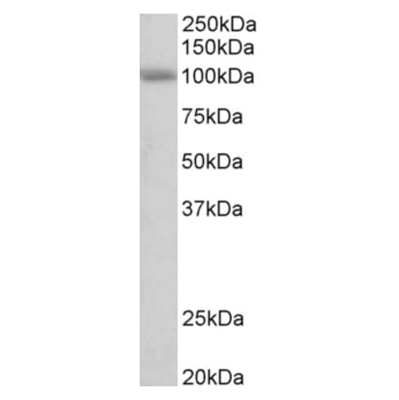 Western Blot - Anti-SIDT1 Antibody (A84990) - Antibodies.com