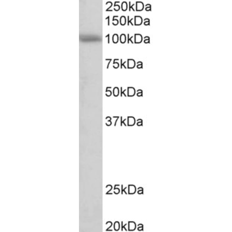Western Blot - Anti-SIDT1 Antibody (A84990) - Antibodies.com